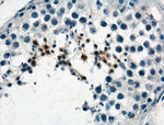 PIH1D3 Antibody in Immunohistochemistry (Paraffin) (IHC (P))