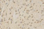 CAMK2N1 Antibody in Immunohistochemistry (Paraffin) (IHC (P))