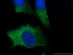 FGF17 Antibody in Immunocytochemistry (ICC/IF)