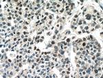 RUNX1 (middle) Antibody in Immunohistochemistry (Paraffin) (IHC (P))