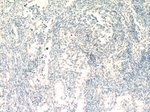 RUNX1 (middle) Antibody in Immunohistochemistry (Paraffin) (IHC (P))