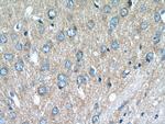 ATP6V1G2 Antibody in Immunohistochemistry (Paraffin) (IHC (P))