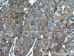 Desmoplakin Antibody in Immunohistochemistry (Paraffin) (IHC (P))