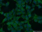 CHD3 Antibody in Immunocytochemistry (ICC/IF)