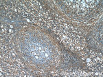 CHD3 Antibody in Immunohistochemistry (Paraffin) (IHC (P))
