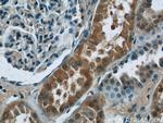 CHD3 Antibody in Immunohistochemistry (Paraffin) (IHC (P))