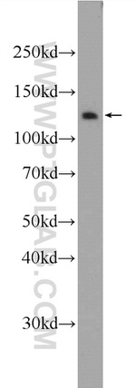 RTEL1 Antibody in Western Blot (WB)