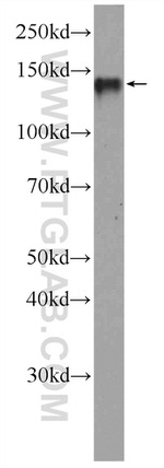 RTEL1 Antibody in Western Blot (WB)