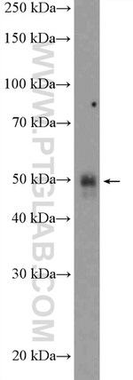 AGTR1 Antibody in Western Blot (WB)