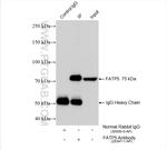 FATP5 Antibody in Immunoprecipitation (IP)