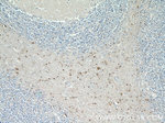 TNRC4 Antibody in Immunohistochemistry (Paraffin) (IHC (P))