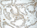 TNRC4 Antibody in Immunohistochemistry (Paraffin) (IHC (P))