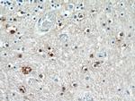 TNRC4 Antibody in Immunohistochemistry (Paraffin) (IHC (P))