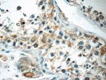TNRC4 Antibody in Immunohistochemistry (Paraffin) (IHC (P))