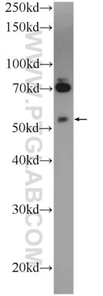 TNRC4 Antibody in Western Blot (WB)