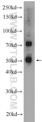 TNRC4 Antibody in Western Blot (WB)