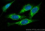 ABHD11 Antibody in Immunocytochemistry (ICC/IF)
