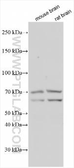 ABHD11 Antibody in Western Blot (WB)