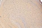 ACCN5 Antibody in Immunohistochemistry (Paraffin) (IHC (P))