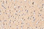 ACCN5 Antibody in Immunohistochemistry (Paraffin) (IHC (P))