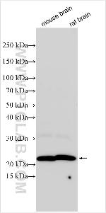 PPP1R16B Antibody in Western Blot (WB)