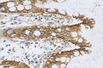 MRP3/ABCC3 Antibody in Immunohistochemistry (Paraffin) (IHC (P))