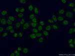 SBNO1 Antibody in Immunocytochemistry (ICC/IF)