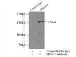 SBNO1 Antibody in Immunoprecipitation (IP)