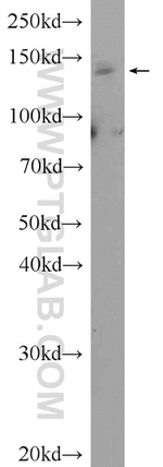 SBNO1 Antibody in Western Blot (WB)