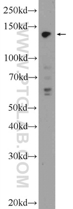 SBNO1 Antibody in Western Blot (WB)
