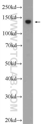 SBNO1 Antibody in Western Blot (WB)