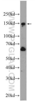 SBNO1 Antibody in Western Blot (WB)