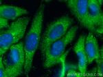 ZFYVE28 Antibody in Immunocytochemistry (ICC/IF)