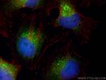 ZFYVE28 Antibody in Immunocytochemistry (ICC/IF)