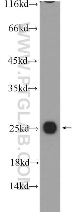 C1orf163 Antibody in Western Blot (WB)