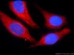 C3orf43 Antibody in Immunocytochemistry (ICC/IF)