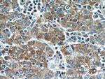 TMEM182 Antibody in Immunohistochemistry (Paraffin) (IHC (P))