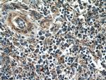 YOD1 Antibody in Immunohistochemistry (Paraffin) (IHC (P))