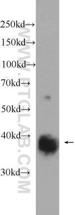 REM2 Antibody in Western Blot (WB)