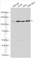 Exportin 4 Antibody in Western Blot (WB)