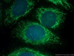 TRNT1 Antibody in Immunocytochemistry (ICC/IF)