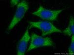 TMEM200A Antibody in Immunocytochemistry (ICC/IF)