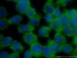 TMEM200A Antibody in Immunocytochemistry (ICC/IF)