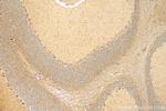 TMEM200A Antibody in Immunohistochemistry (Paraffin) (IHC (P))