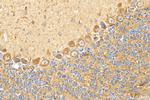 TMEM200A Antibody in Immunohistochemistry (Paraffin) (IHC (P))