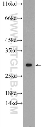 NUP62CL Antibody in Western Blot (WB)