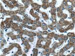 MTF1 Antibody in Immunohistochemistry (Paraffin) (IHC (P))