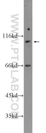 FAM160B1 Antibody in Western Blot (WB)