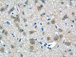 CHERP Antibody in Immunohistochemistry (Paraffin) (IHC (P))