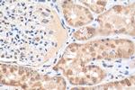 CHERP Antibody in Immunohistochemistry (Paraffin) (IHC (P))